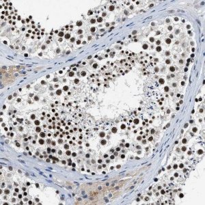 Anti-CCNE1 antibody produced in rabbit 