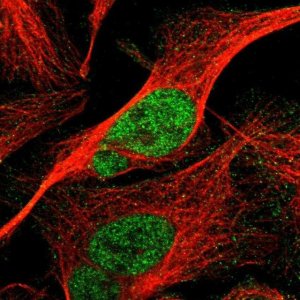 Anti-CCNE1 antibody produced in rabbit 