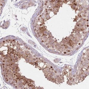 Anti-CCNI antibody produced in rabbit 