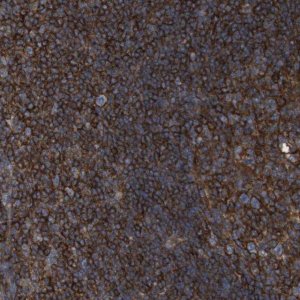Anti-CCR6 antibody produced in rabbit 