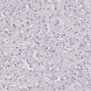 Anti-CCR8 antibody produced in rabbit 