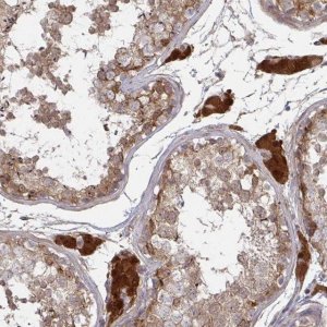 Anti-CCS antibody produced in rabbit 