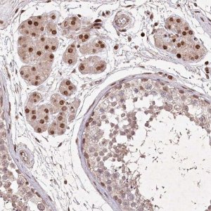 Anti-CCSER2 antibody produced in rabbit 