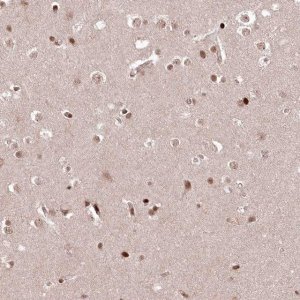 Anti-CCSER2 antibody produced in rabbit 