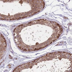 Anti-CCT6A antibody produced in rabbit HPA049949-100UL