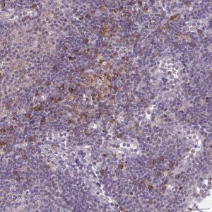 Anti-CD1E antibody produced in rabbit HPA057769-100UL