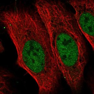 Anti-CDADC1 antibody produced in rabbit 