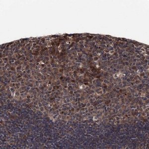 Anti-CDC23 antibody produced in rabbit 