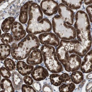 Anti-CDC34 antibody produced in rabbit 
