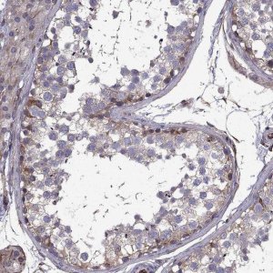 Anti-CDC42BPA antibody produced in rabbit 