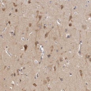 Anti-CDC42BPB antibody produced in rabbit 
