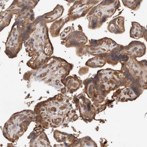Anti-CDC42BPB antibody produced in rabbit 