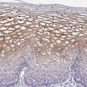 Anti-CDC42BPG antibody produced in rabbit 