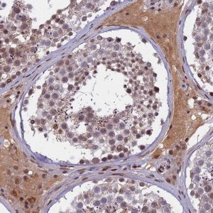 Anti-CDC7 antibody produced in rabbit 