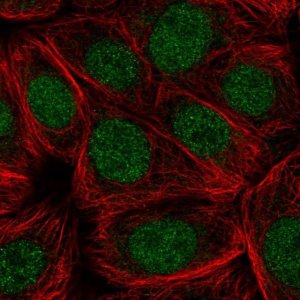 Anti-CDC73 antibody produced in rabbit 