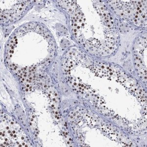 Anti-CDCA2 antibody produced in rabbit 