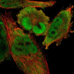 Anti-CDCA7 antibody produced in rabbit 