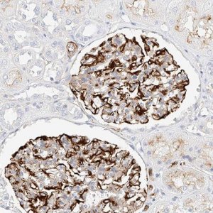 Anti-CDCP2 antibody produced in rabbit 