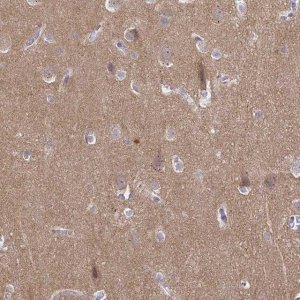 Anti-CDH18 antibody produced in rabbit 