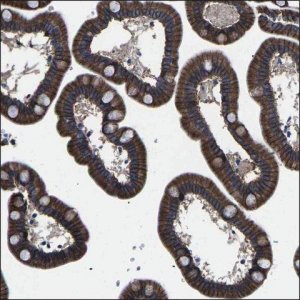 Anti-CDH18 antibody produced in rabbit HPA014365-100UL