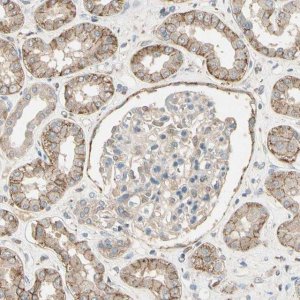 Anti-CDH6 antibody produced in rabbit 