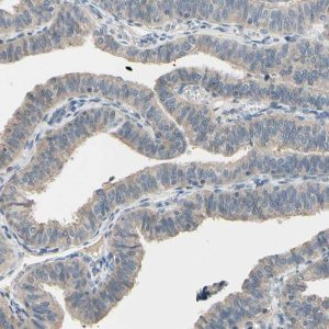 Anti-CDH6 antibody produced in rabbit 