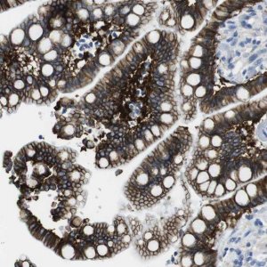 Anti-CDH8 antibody produced in rabbit 