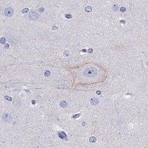 Anti-CDH9 antibody produced in rabbit 