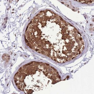 Anti-CDIP1 antibody produced in rabbit 