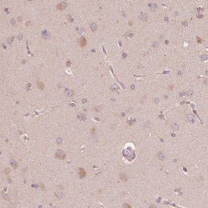 Anti-CDIPT antibody produced in rabbit 