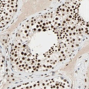 ANTI-CDK12 antibody produced in rabbit 