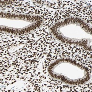 ANTI-CDK12 antibody produced in rabbit 