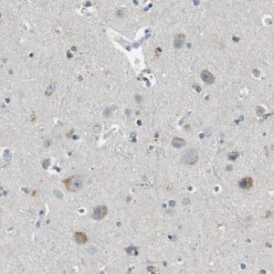 Anti-CDK14 antibody produced in rabbit 