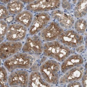 Anti-CDK14 antibody produced in rabbit 