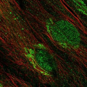 ANTI-CDK15 antibody produced in rabbit 