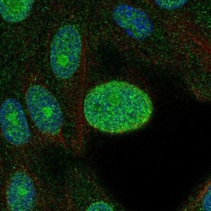 Anti-CDK4 antibody produced in rabbit 
