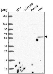 Anti-CDK5RAP1 antibody produced in rabbit 