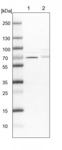 Anti-CDK5RAP3 antibody produced in rabbit 