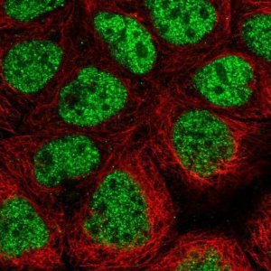 Anti-CDK8 antibody produced in rabbit 