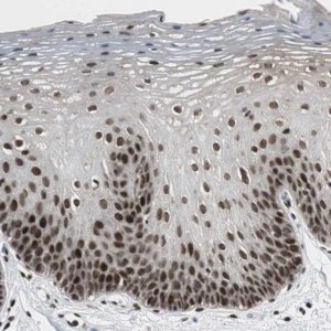 Anti-CDK9 antibody produced in rabbit 