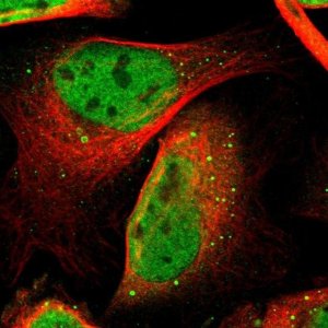 Anti-CDK9 antibody produced in rabbit 