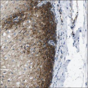 Anti-CDKAL1 antibody produced in rabbit HPA014374-100UL