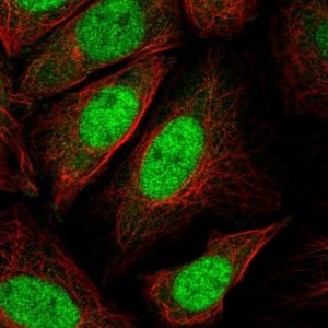 Anti-CDKN1B antibody produced in rabbit 