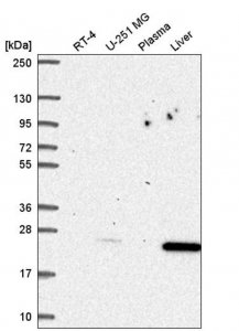 Anti-CDKN1B antibody produced in rabbit 