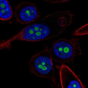 Anti-CDKN2A antibody produced in rabbit 