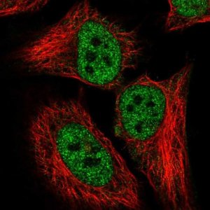 Anti-CDKN2AIP antibody produced in rabbit 