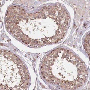 Anti-CDKN2AIPNL antibody produced in rabbit 