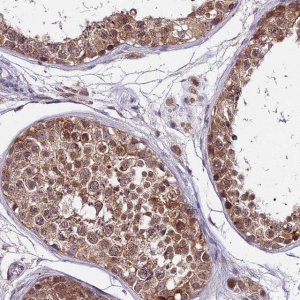Anti-CDNF antibody produced in rabbit 