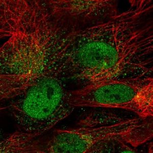Anti-CDR1 antibody produced in rabbit 