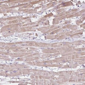 Anti-CDRT15 antibody produced in rabbit 